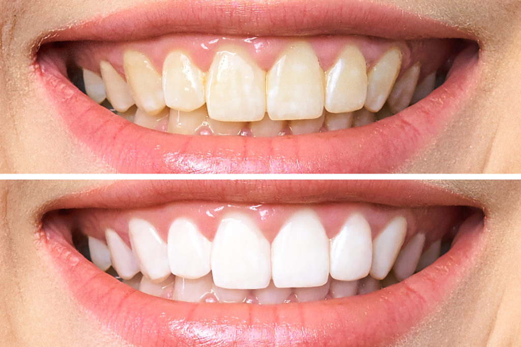 ¿QUIERES UNA SONRISA PERFECTA?  ¡SÍ ES POSIBLE!